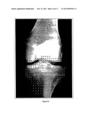 METHODS FOR THE COMPENSATION OF IMAGING TECHNIQUE IN THE PROCESSING OF     RADIOGRAPHIC IMAGES diagram and image