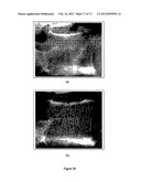 METHODS FOR THE COMPENSATION OF IMAGING TECHNIQUE IN THE PROCESSING OF     RADIOGRAPHIC IMAGES diagram and image