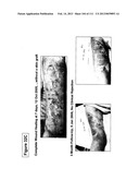 ISOLATION AND CULTIVATION OF STEM/PROGENITOR CELLS FROM THE AMNIOTIC     MEMBRANE OF UMBILICAL CORD AND USES OF CELLS DIFFERENTIATED THEREFROM diagram and image