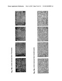 ISOLATION AND CULTIVATION OF STEM/PROGENITOR CELLS FROM THE AMNIOTIC     MEMBRANE OF UMBILICAL CORD AND USES OF CELLS DIFFERENTIATED THEREFROM diagram and image