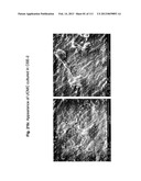 ISOLATION AND CULTIVATION OF STEM/PROGENITOR CELLS FROM THE AMNIOTIC     MEMBRANE OF UMBILICAL CORD AND USES OF CELLS DIFFERENTIATED THEREFROM diagram and image