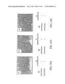 Methods of Evaluating Transplant Rejection diagram and image