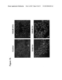 METHOD OF TREATING ACUTE MYELOGENOUS LEUKEMIA diagram and image