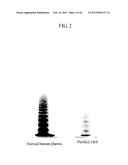 von Willebrand Factor (vWF) - Cleaving Protease diagram and image