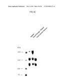 von Willebrand Factor (vWF) - Cleaving Protease diagram and image