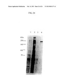 von Willebrand Factor (vWF) - Cleaving Protease diagram and image