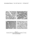 ANTIBODIES THAT BIND TO PSCA PROTEINS FOR DIAGNOSIS OF CANCER diagram and image