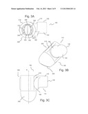 BLOOD FLOW ASSIST DEVICES, SYSTEMS AND METHODS diagram and image