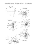 BLOOD FLOW ASSIST DEVICES, SYSTEMS AND METHODS diagram and image