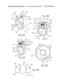 CONTROL OF BLOOD FLOW ASSIST SYSTEMS diagram and image