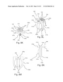 CONTROL OF BLOOD FLOW ASSIST SYSTEMS diagram and image