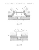 EPIDERMAL DOWN-GROWTH BARRIER diagram and image