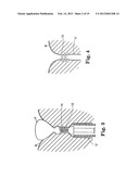 SURGICAL ARTICLES FOR PLACING AN IMPLANT ABOUT A TUBULAR TISSUE STRUCTURE     AND METHODS diagram and image