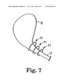 SURGICAL ARTICLES FOR PLACING AN IMPLANT ABOUT A TUBULAR TISSUE STRUCTURE     AND METHODS diagram and image