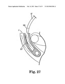 SURGICAL ARTICLES FOR PLACING AN IMPLANT ABOUT A TUBULAR TISSUE STRUCTURE     AND METHODS diagram and image