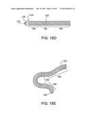 METHODS AND APPARATUS FOR OFF-AXIS VISUALIZATION diagram and image