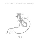 METHODS AND APPARATUS FOR OFF-AXIS VISUALIZATION diagram and image