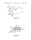 METHODS AND APPARATUS FOR OFF-AXIS VISUALIZATION diagram and image