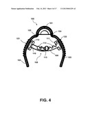 MINIMALLY OBSTRUCTIVE RETRACTOR diagram and image