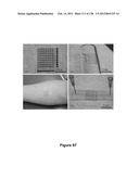 Flexible and Stretchable Electronic Systems for Epidermal Electronics diagram and image