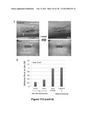 Flexible and Stretchable Electronic Systems for Epidermal Electronics diagram and image