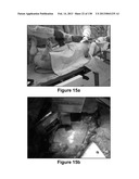 Flexible and Stretchable Electronic Systems for Epidermal Electronics diagram and image