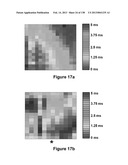 Flexible and Stretchable Electronic Systems for Epidermal Electronics diagram and image