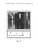 Flexible and Stretchable Electronic Systems for Epidermal Electronics diagram and image