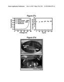 Flexible and Stretchable Electronic Systems for Epidermal Electronics diagram and image