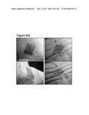 Flexible and Stretchable Electronic Systems for Epidermal Electronics diagram and image