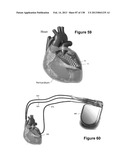 Flexible and Stretchable Electronic Systems for Epidermal Electronics diagram and image