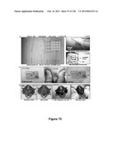 Flexible and Stretchable Electronic Systems for Epidermal Electronics diagram and image