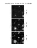 ELECTROCHEMICAL DISINFECTION OF IMPLANTED CATHETERS diagram and image