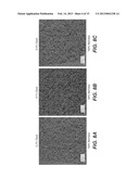 ELECTROCHEMICAL DISINFECTION OF IMPLANTED CATHETERS diagram and image