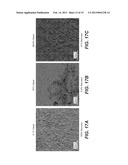 ELECTROCHEMICAL DISINFECTION OF IMPLANTED CATHETERS diagram and image