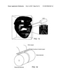 METHODS AND APPARATUS FOR INTRODUCING CELLS AT A TISSUE SITE diagram and image