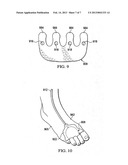 FOOT MANIFOLDS, APPARATUSES, SYSTEMS, AND METHODS FOR APPLYING REDUCED     PRESSURE TO A TISSUE SITE ON A FOOT diagram and image