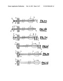 METHOD AND DEVICE FOR CLOSING HOLES IN TISSUE diagram and image