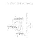 METHOD AND APPARATUS FOR TREATING CANCER diagram and image