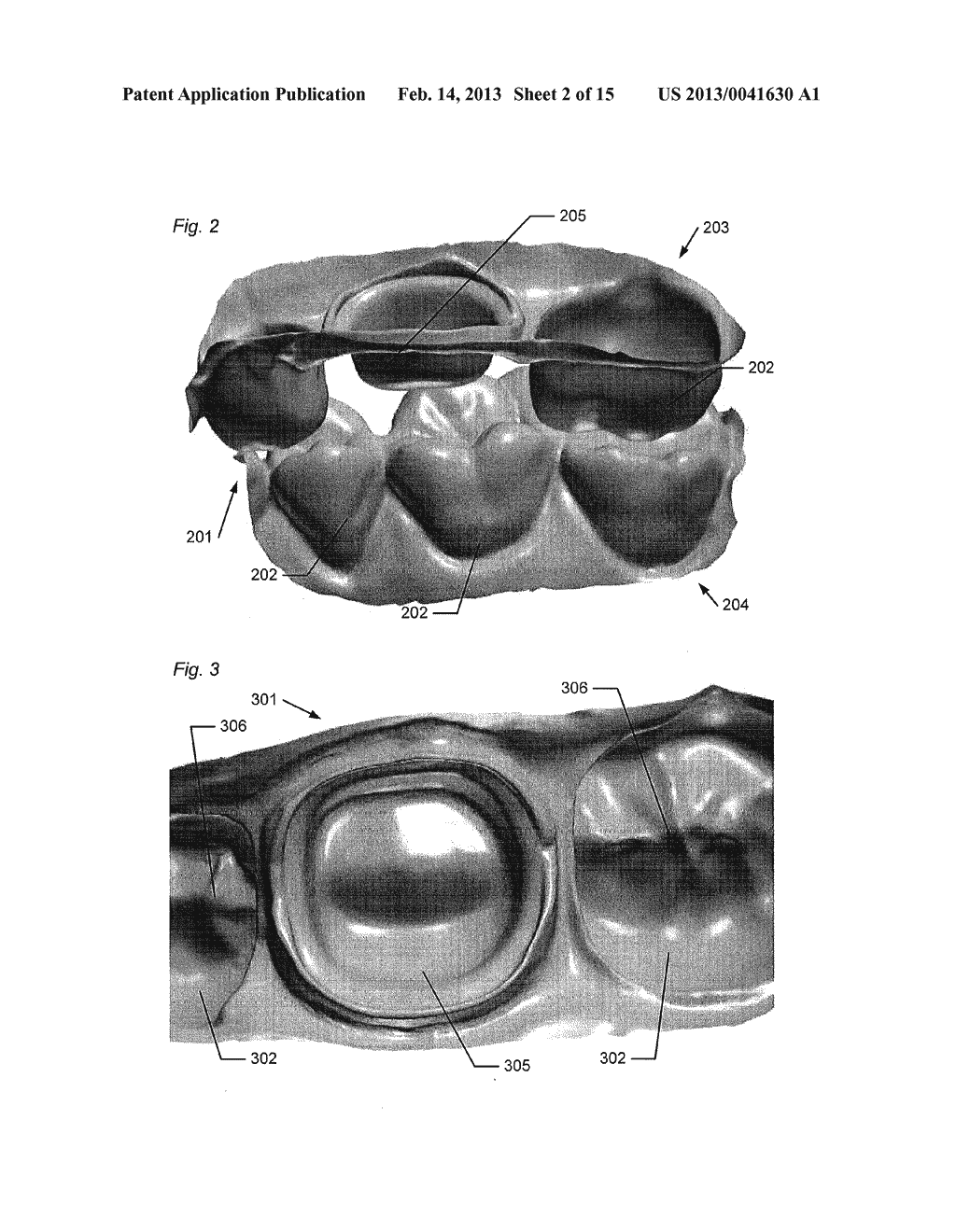 SUPPORT OF REMOVABLE COMPONENTS IN A TEETH MODEL MANUFACTURED BY MEANS OF     CAM - diagram, schematic, and image 03