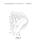 TONGUE RETAINING DEVICE diagram and image