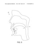 TONGUE RETAINING DEVICE diagram and image