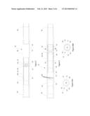 High Flow Rate Multi Array Stimulation System diagram and image