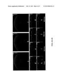 OPTICAL COHERENCE TOMOGRAPHY SYSTEM HAVING REAL-TIME ARTIFACT AND     SATURATION CORRECTION diagram and image