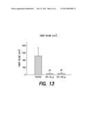 Method for Treating Prostate Cancer diagram and image