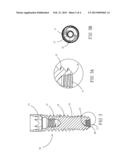 DENTAL IMPLANT FIXING SYSTEM diagram and image