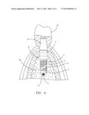 DENTAL IMPLANT FIXING SYSTEM diagram and image