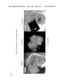 CLEARING REAGENT FOR BIOLOGICAL MATERIAL, AND USE THEREOF diagram and image