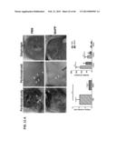 PLA2ACTIVITY AS A MARKER FOR OVARIAN AND OTHER GYNECOLOGIC CANCERS diagram and image