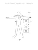 WIRELESS ECG IN IMPLANTABLE DEVICES diagram and image